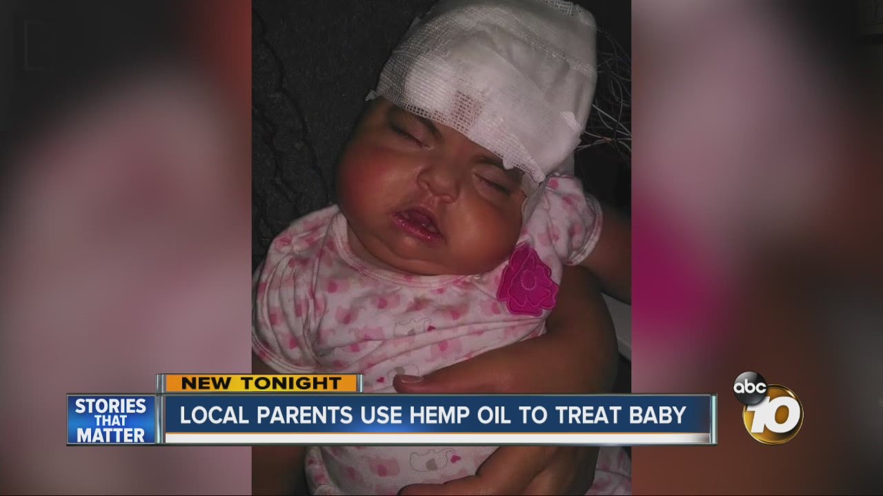 Local parents use hemp oil to treat baby