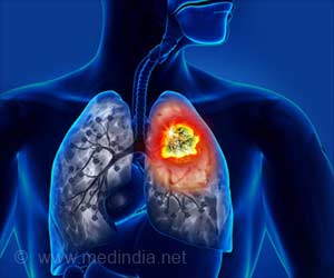 Anti-allergy Drug Dupilumab Treats Lung Cancer