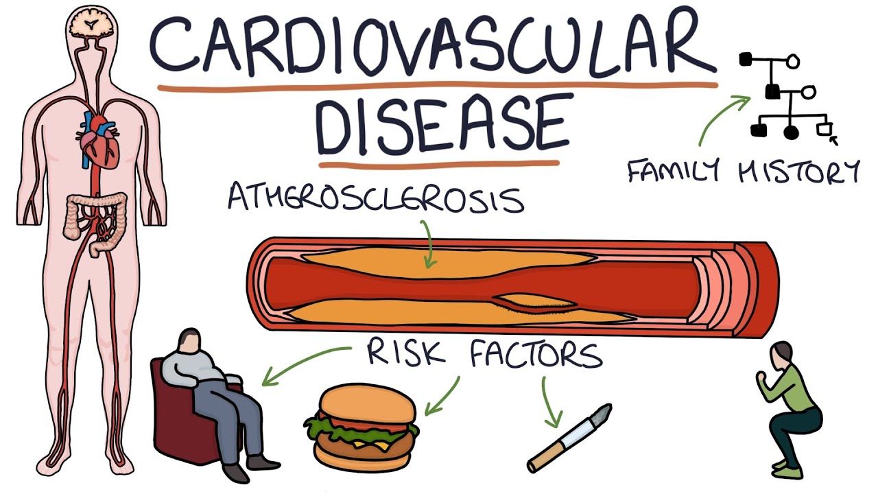 Understanding Cardiovascular Disease: Visual Explanation for Students