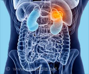 New Use of Old Drug Decreases Kidney Cancer Risk Returning