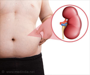 Chennai Man Has 5 Kidneys After Renal Transplant