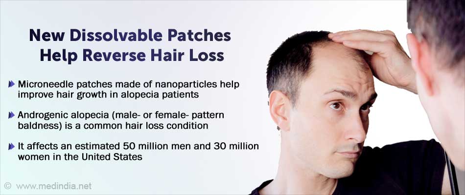 New Microneedle Patches Help Reverse Baldness