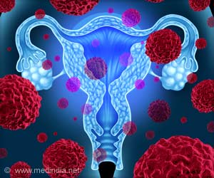 New Findings in Ovarian Cancer