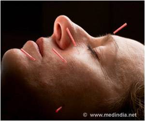 Electroacupuncture Procedures Help Reduce Pain in Patients After Surgery