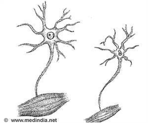 Breakthrough in Understanding Motor Neuron Disease