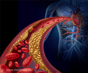 Bone Marrow Factors Behind Cardiovascular Diseases