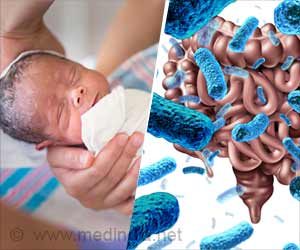 Antibiotics After Birth Affect the Gut Microbes of Babies