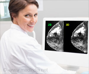 50% Women Experience False Positive Mammograms After 10 Years of Annual Screening: Study