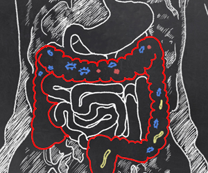 Green Synthesis to Provide Drug for Inflammatory Bowel Disease