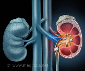 Lithium Helps Improve Kidney Health