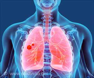 COVID-19 Caused Lung Diseases in some Hospitalized Patients