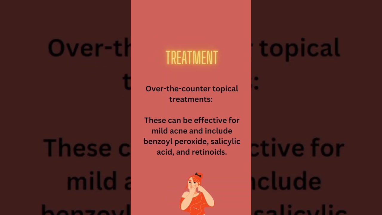 Acne it's causes and treatment #usa #pakistan #india#health #fitness #support #wellness