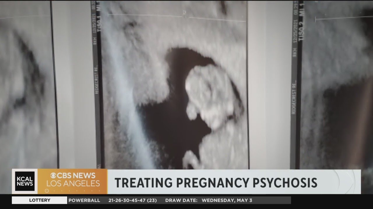 Treating pregnancy psychosis