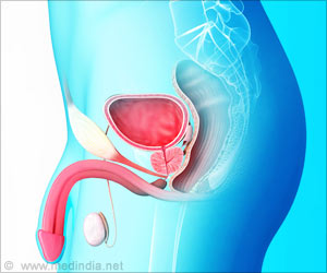 Gut Microbiota’s Link to Prostate Inflammation in Aging Men