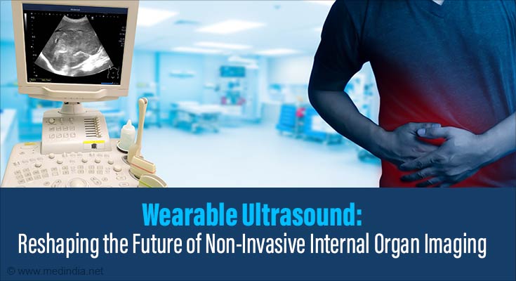 Wearable Ultrasound Patch Redefining Health Monitoring