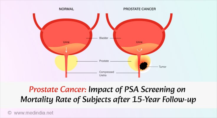 Effect of PSA Screening on Prostate Cancer Mortality Rate at 15-Years