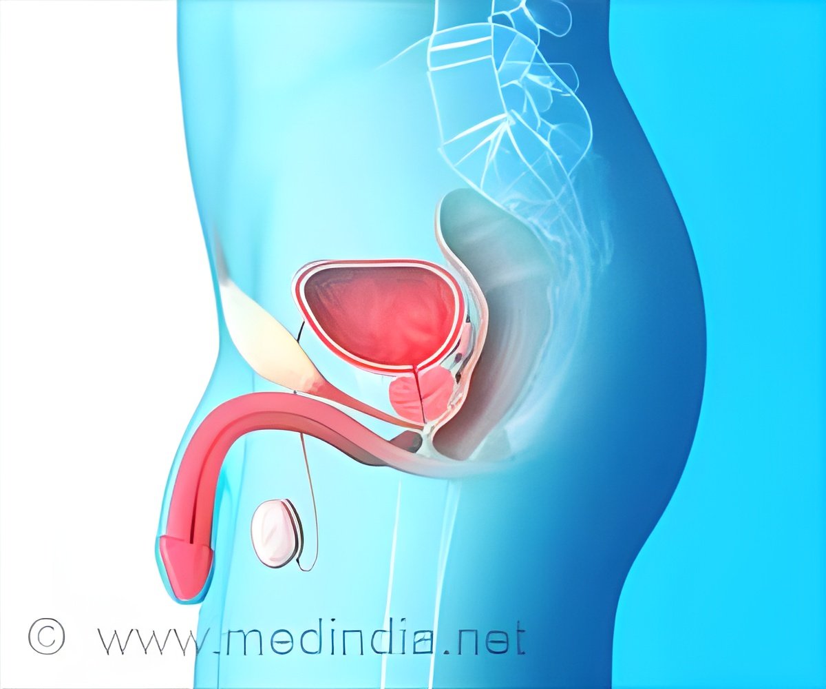 Chemohormonal Therapy Benefits Prostate Cancer Patients