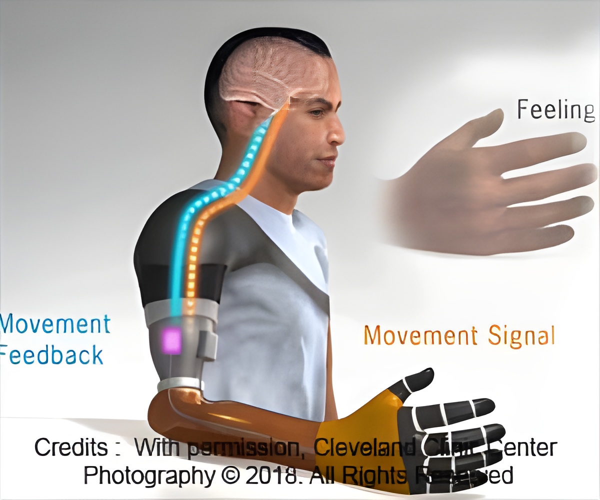 MIT Study Paves the Way for Advanced Prosthetics