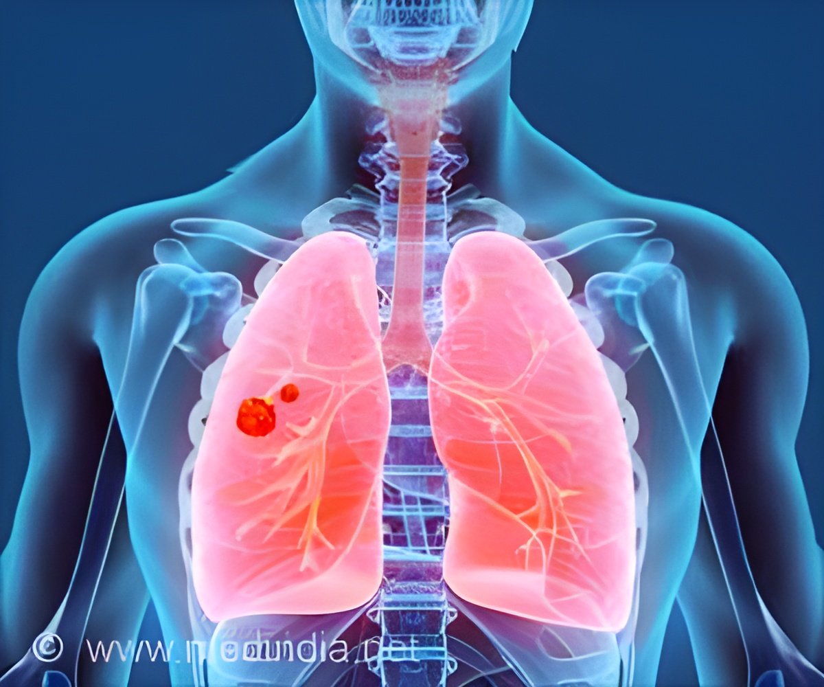 Dual-Action Therapy Targets Lung Cancer