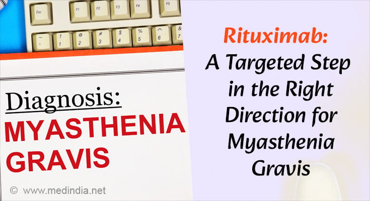 A Targeted Approach With Limitations in Myasthenia Gravis