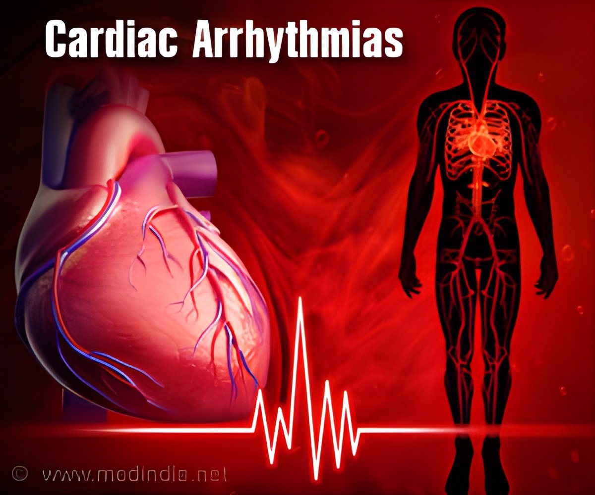 Pulsed Field Ablation Offers New Hope of Heart Arrhythmias