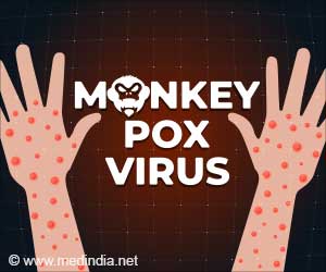 Is Monkeypox the Next Pandemic?