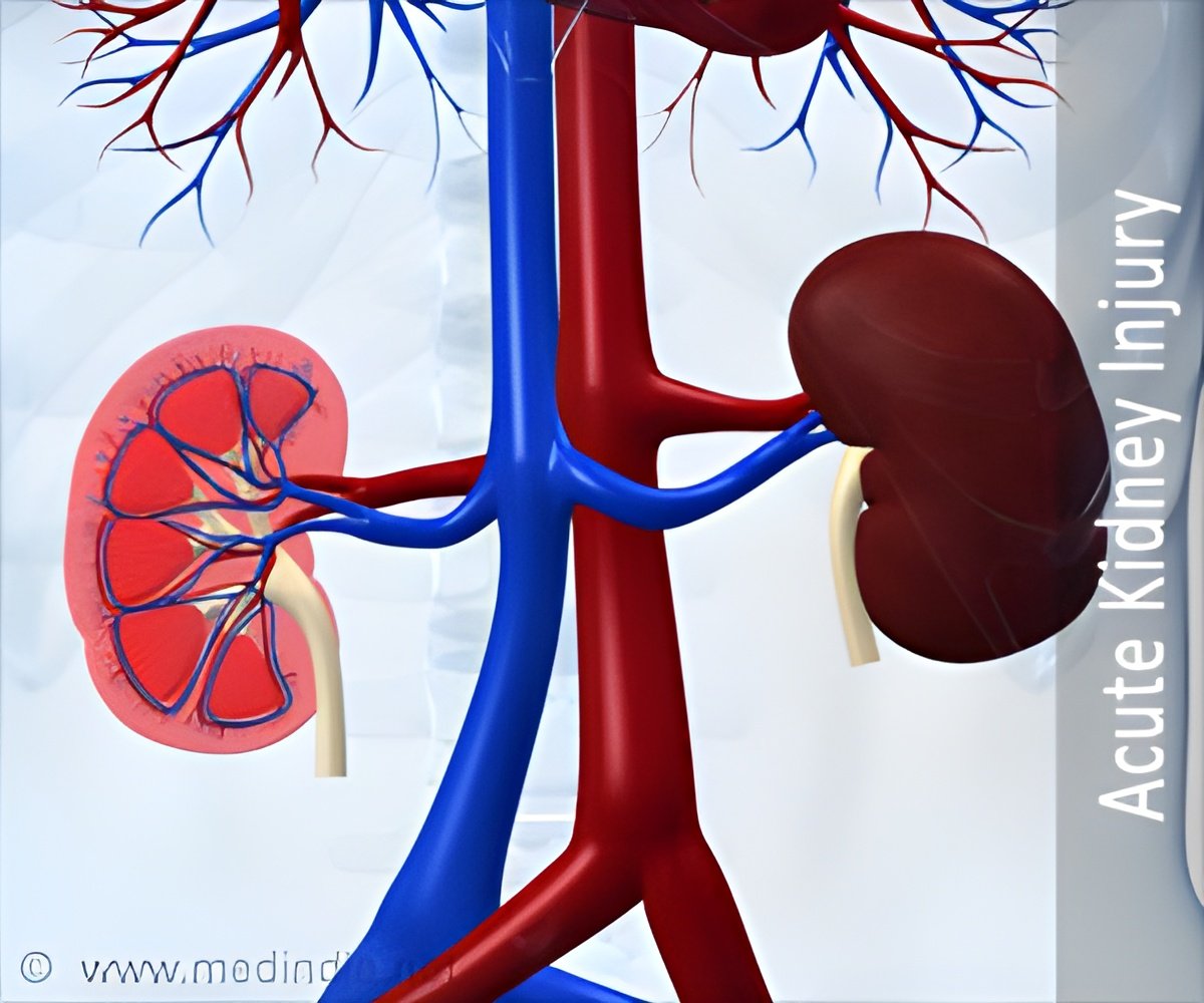 Understanding the Immune Response to Acute Kidney Injury