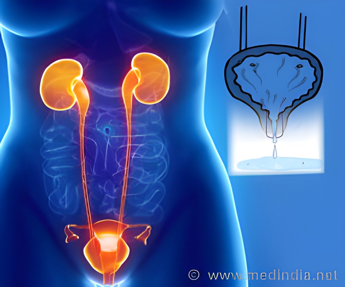 Neuromodulatory Implant Provides Relief from Urinary Urgency Incontinence