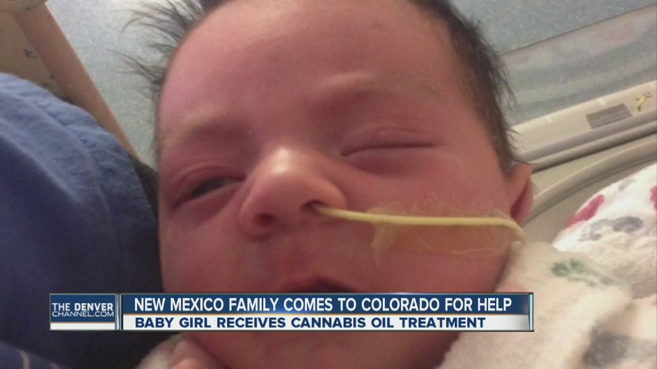 Baby gets cannabis oil treatment in Colorado