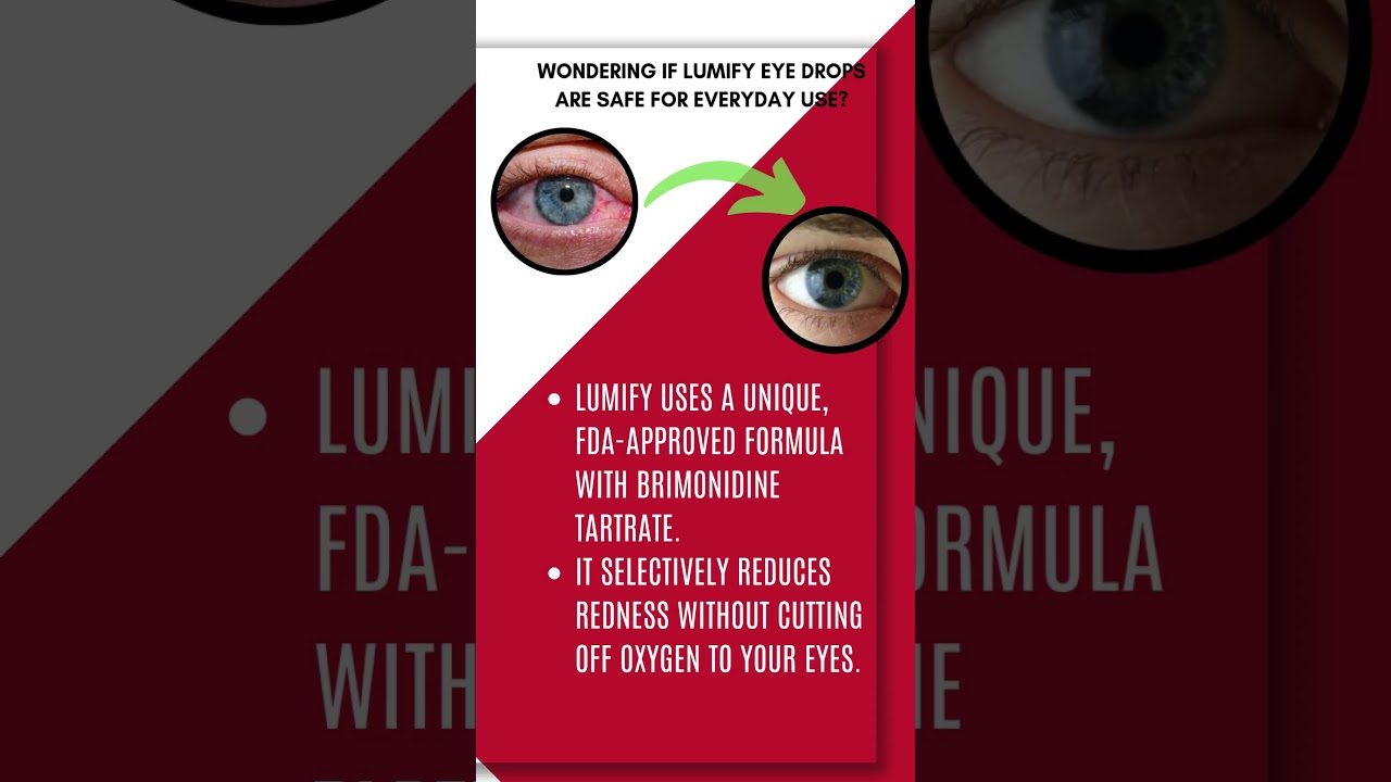 Lumify eye drops | are safe for everyday use? #lumify #eyedrop #indiana #arizona #usa