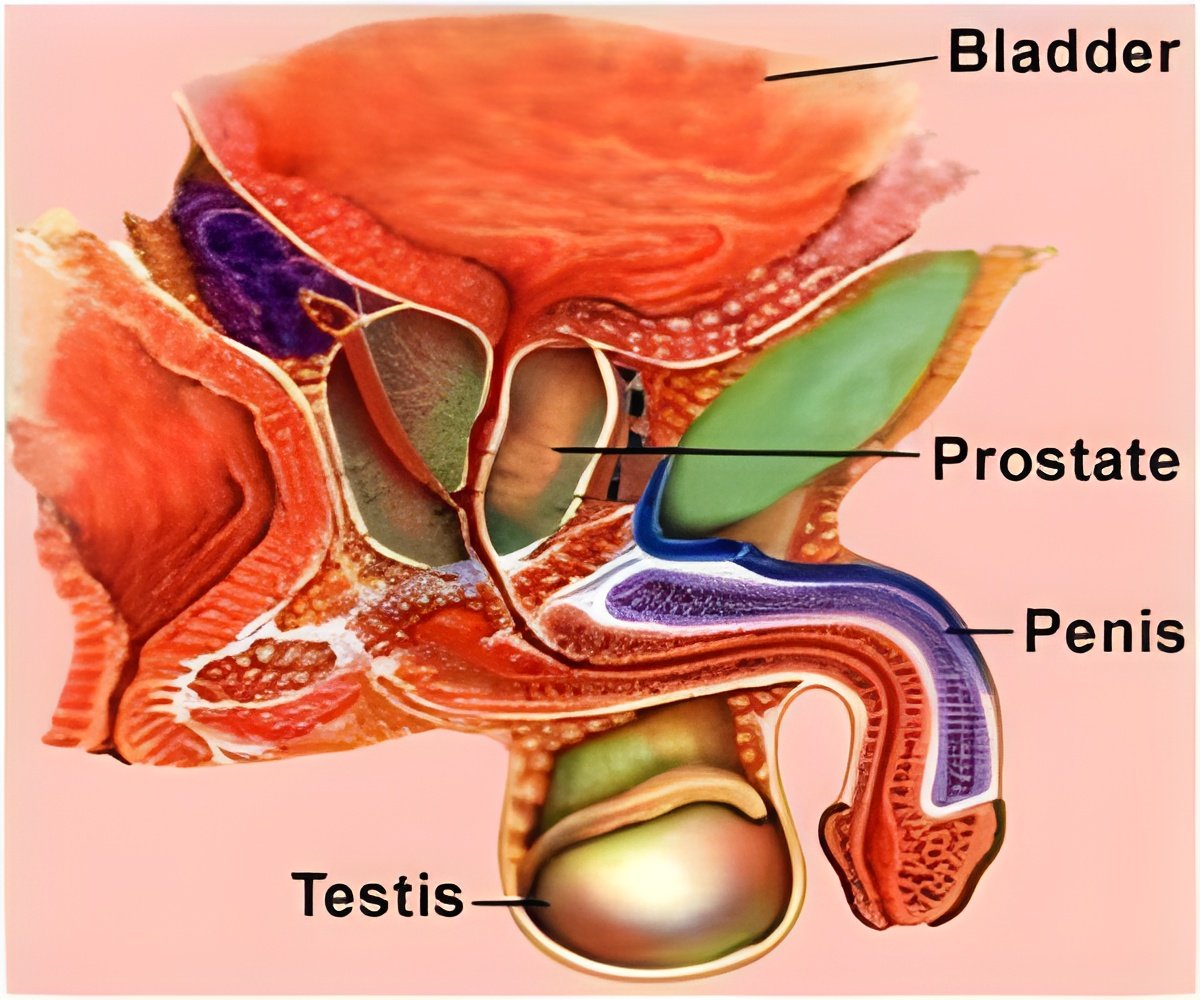 A Breakthrough Hope for Prostate Cancer Care