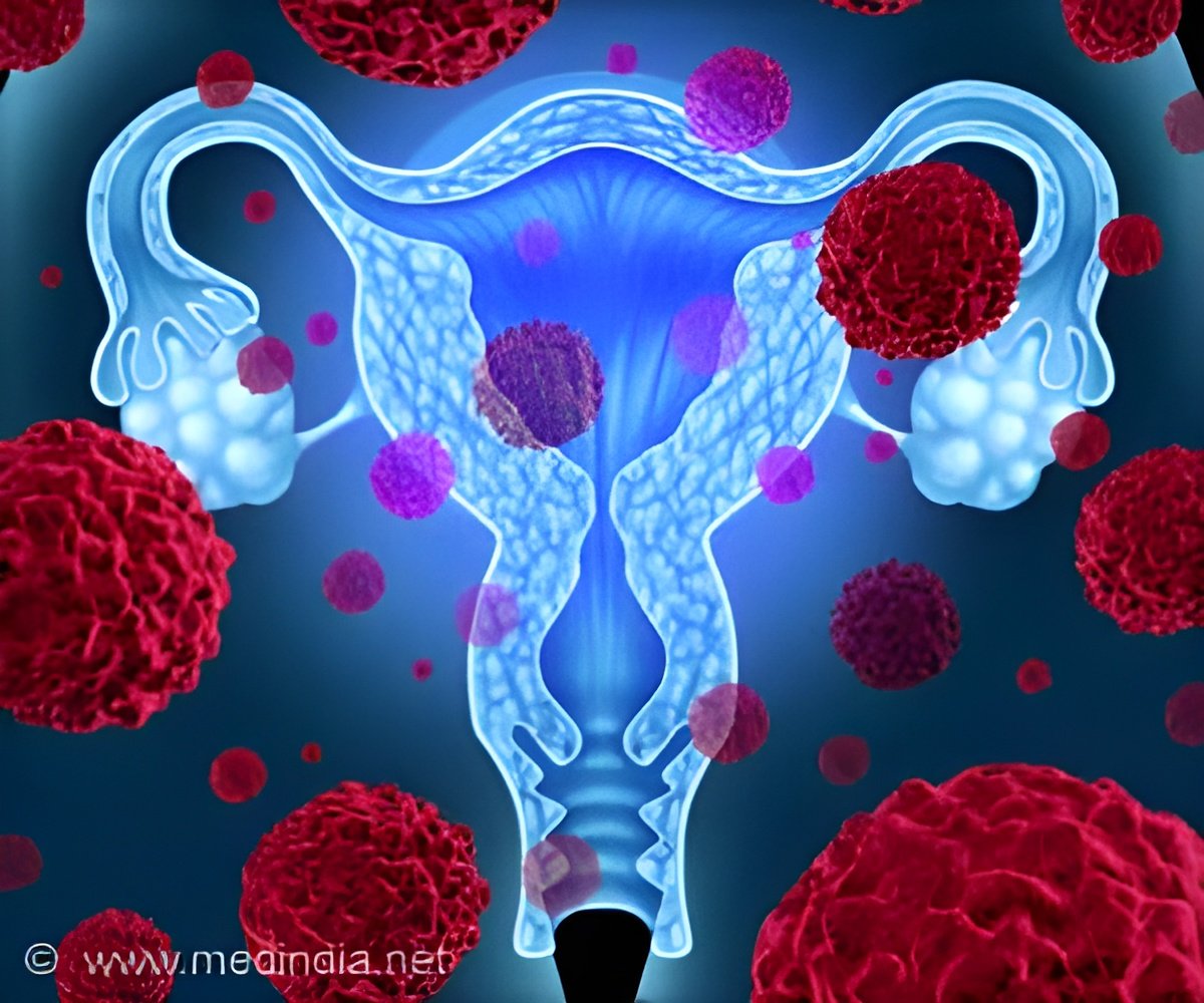 New Front in the Fight Against Ovarian Cancer