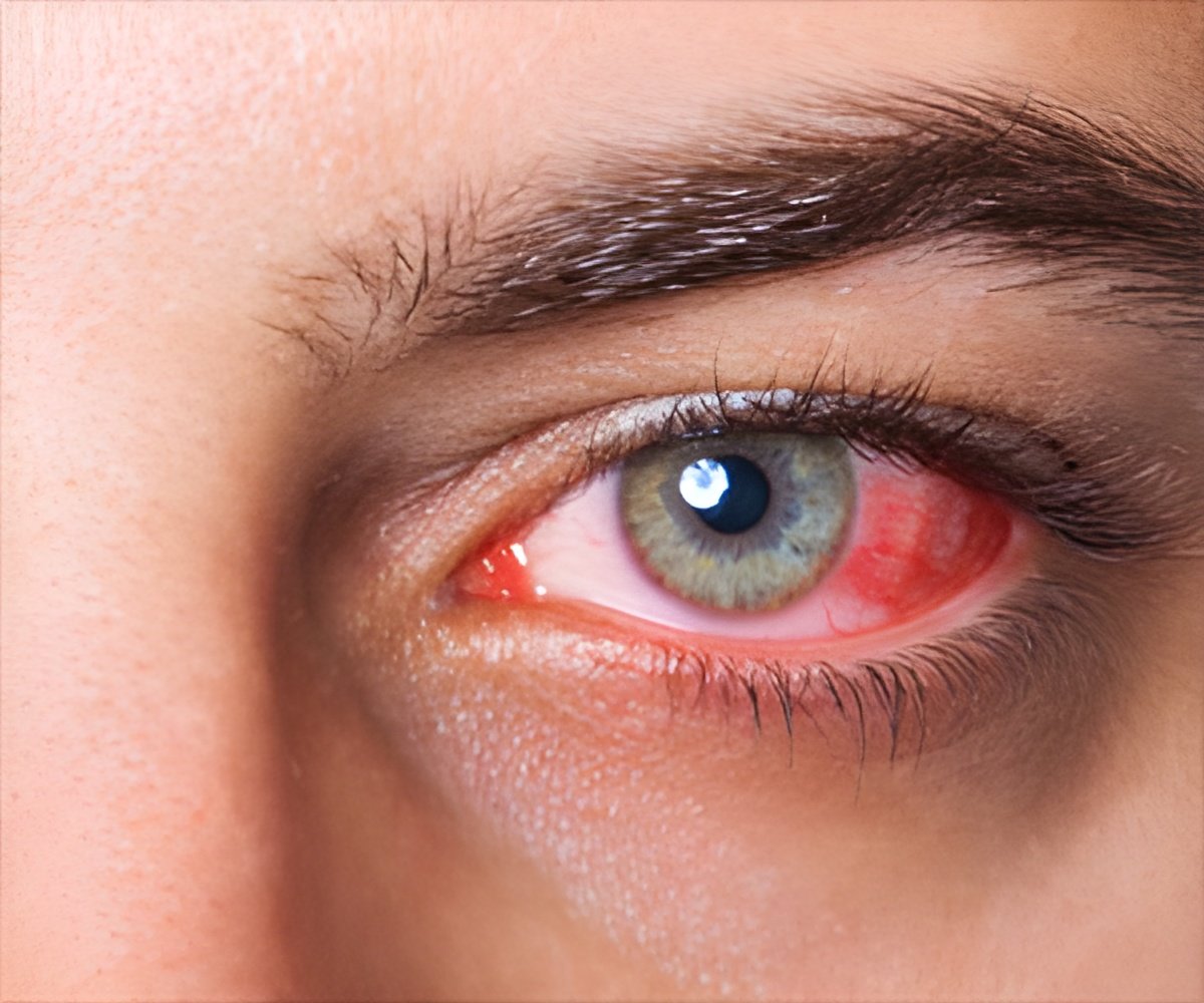 Low-dose Antiviral Therapy Eases Eye Disease and Shingles Pain