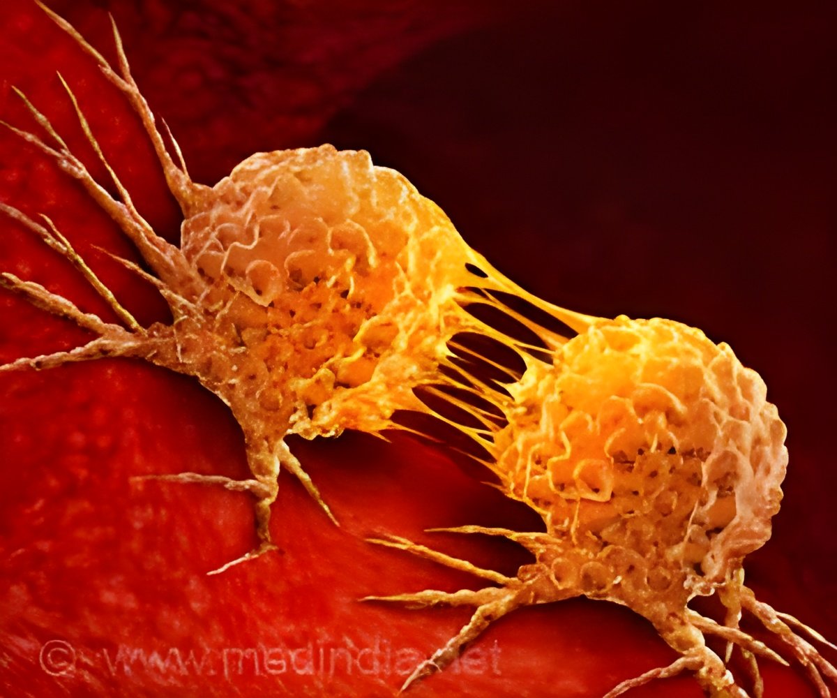 Boosting CAR T-Cell Therapy With DNase I for Melanoma