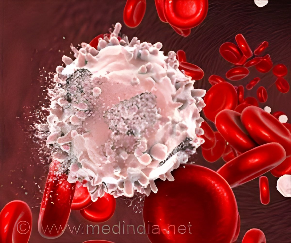 FDA Approves Obe-cel CAR T Therapy for Relapsed B-cell ALL