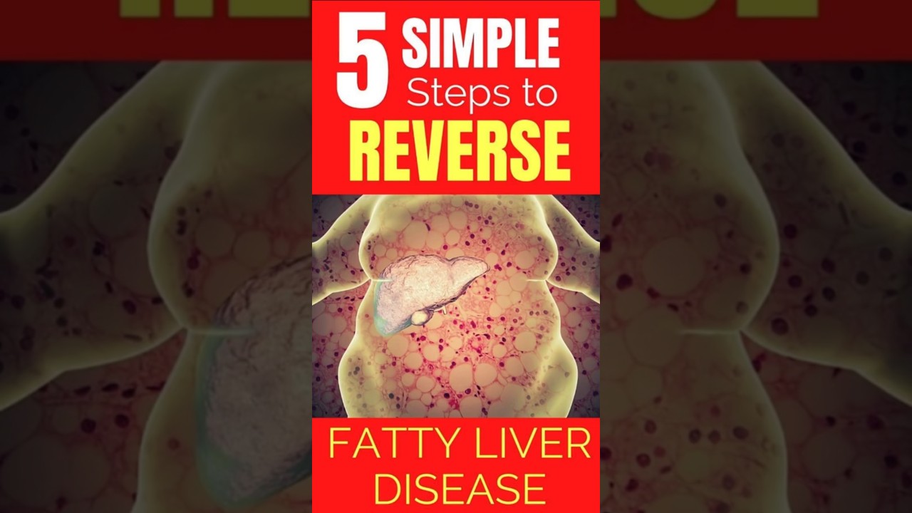 Five Steps to Reverse Fatty Liver. #fattyliver #health #facts #food #usa #america #lifestyle #liver