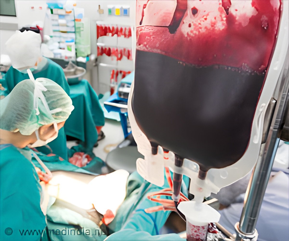 Blood Transfusions Save Lives of Anemic Heart Attack Patients