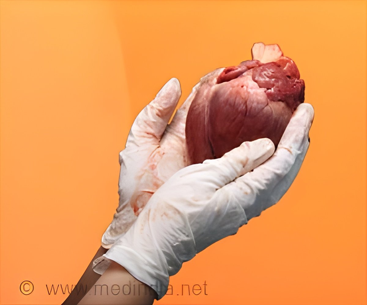 New Blood Test Simplifies Heart Transplant Care